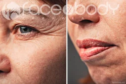 клиника face&body фото 2 - tattooo.ru